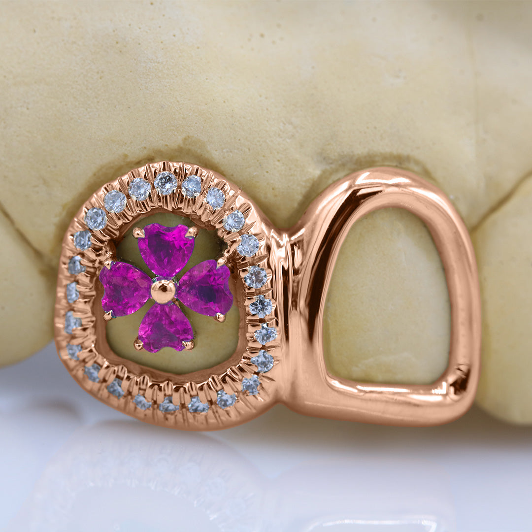 clover_gemstone_grillz_grillz_gold_grillz_grillz_near_me_diamond_grillz_custom_grillz_gold_grillz_near_me_custom_gold_grillz_gold_teeth_grillz_grillz_teeth_near_me_gold_grillz_jewelry_grillz_in_teeth_custom_grillz_near_me_teeth_grillz_grillz_for_teeth_teeth_grillz_near_me_open_face_grillz_grillz_for_teeth_near_me_gold_grillz_teeth_one_tooth_grillz_real_gold_grillz_diamond_grillz_on_teeth_diamond_grillz_teeth_grillz_with_diamond
