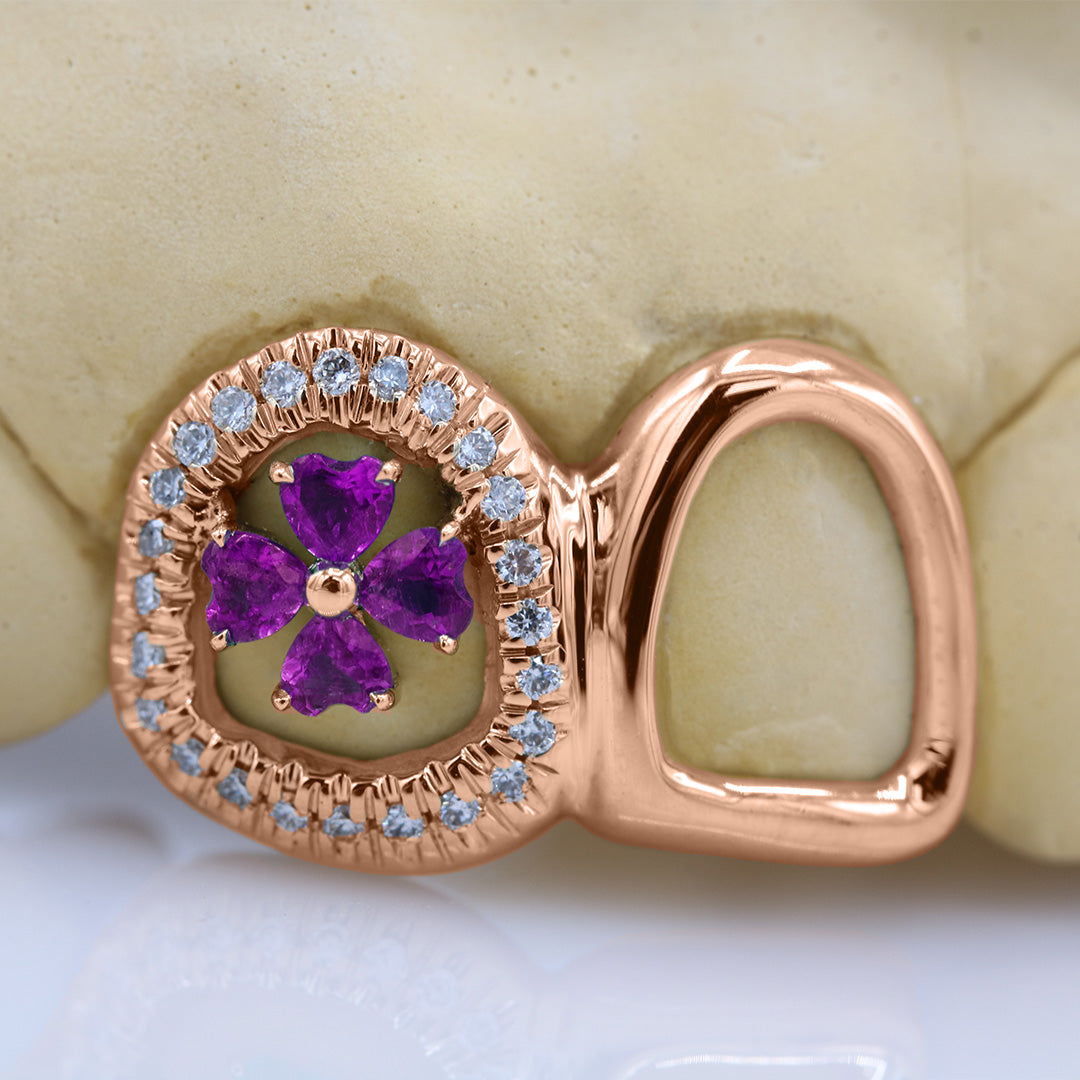 clover_gemstone_grillz_grillz_gold_grillz_grillz_near_me_diamond_grillz_custom_grillz_gold_grillz_near_me_custom_gold_grillz_gold_teeth_grillz_grillz_teeth_near_me_gold_grillz_jewelry_grillz_in_teeth_custom_grillz_near_me_teeth_grillz_grillz_for_teeth_teeth_grillz_near_me_open_face_grillz_grillz_for_teeth_near_me_gold_grillz_teeth_one_tooth_grillz_real_gold_grillz_diamond_grillz_on_teeth_diamond_grillz_teeth_grillz_with_diamond
