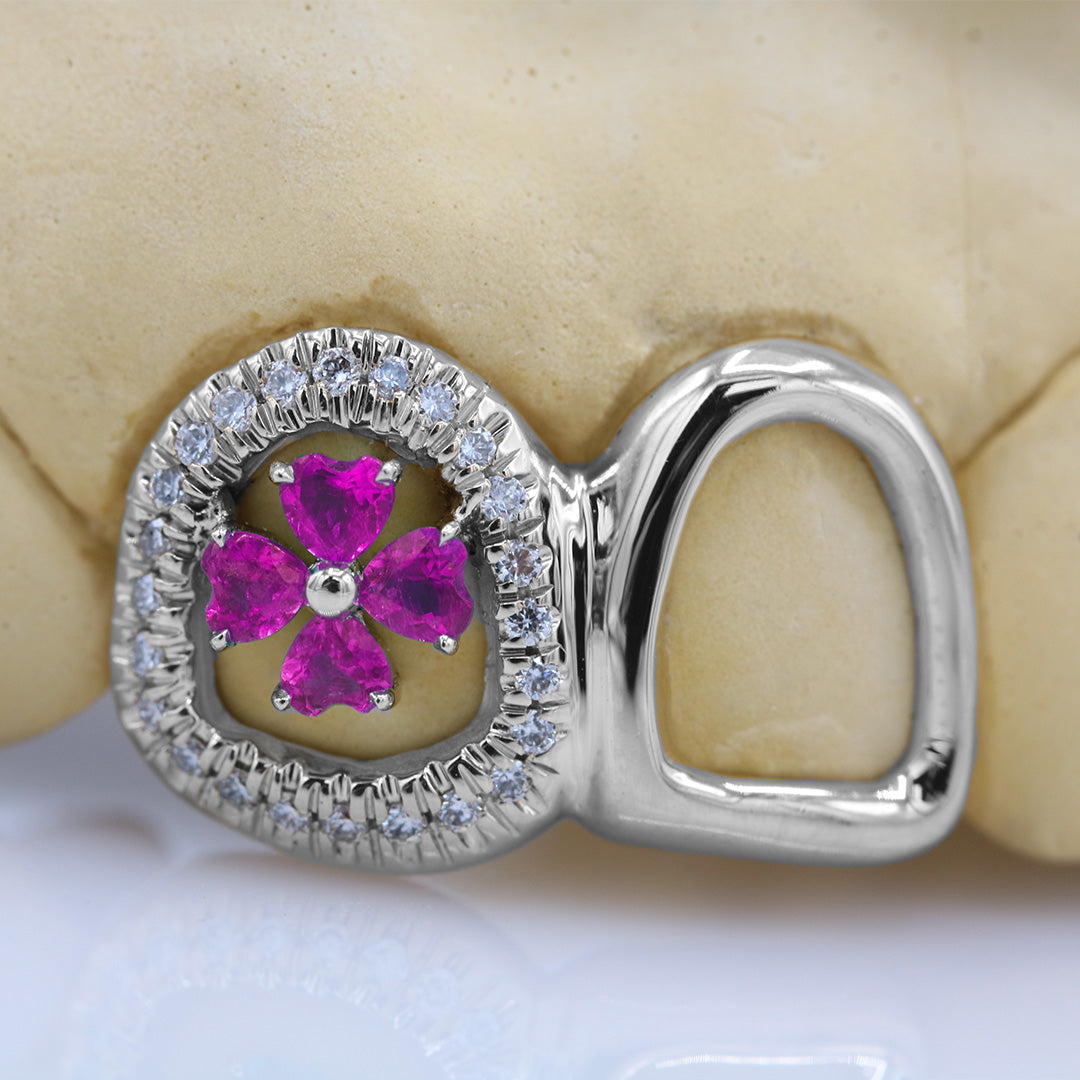 clover_gemstone_grillz_grillz_gold_grillz_grillz_near_me_diamond_grillz_custom_grillz_gold_grillz_near_me_custom_gold_grillz_gold_teeth_grillz_grillz_teeth_near_me_gold_grillz_jewelry_grillz_in_teeth_custom_grillz_near_me_teeth_grillz_grillz_for_teeth_teeth_grillz_near_me_open_face_grillz_grillz_for_teeth_near_me_gold_grillz_teeth_one_tooth_grillz_real_gold_grillz_diamond_grillz_on_teeth_diamond_grillz_teeth_grillz_with_diamond
