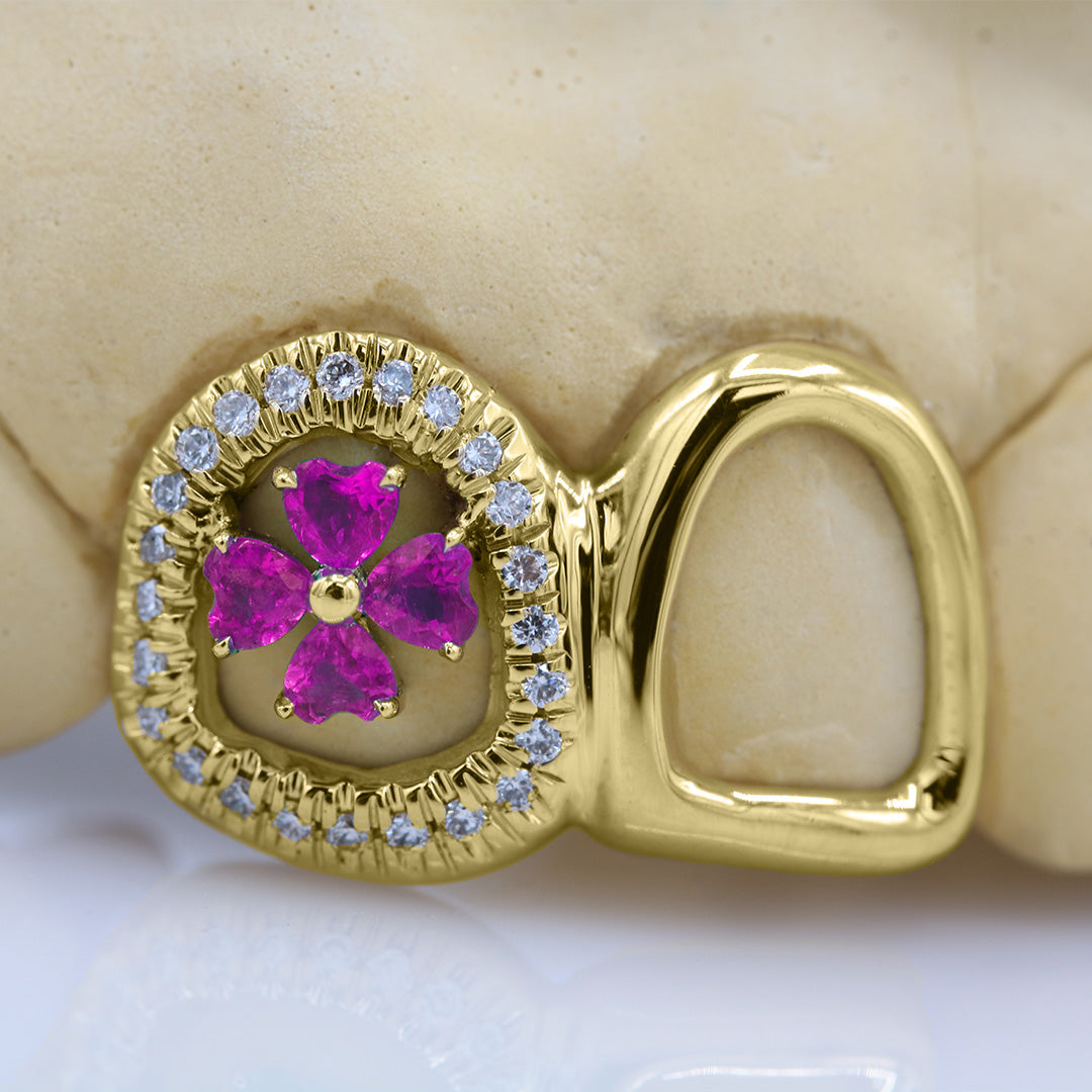 clover_gemstone_grillz_grillz_gold_grillz_grillz_near_me_diamond_grillz_custom_grillz_gold_grillz_near_me_custom_gold_grillz_gold_teeth_grillz_grillz_teeth_near_me_gold_grillz_jewelry_grillz_in_teeth_custom_grillz_near_me_teeth_grillz_grillz_for_teeth_teeth_grillz_near_me_open_face_grillz_grillz_for_teeth_near_me_gold_grillz_teeth_one_tooth_grillz_real_gold_grillz_diamond_grillz_on_teeth_diamond_grillz_teeth_grillz_with_diamond
