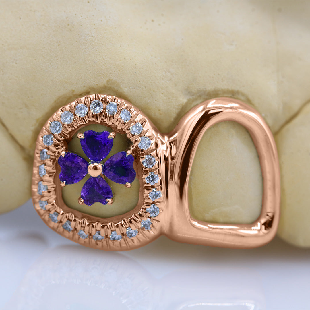 clover_gemstone_grillz_grillz_gold_grillz_grillz_near_me_diamond_grillz_custom_grillz_gold_grillz_near_me_custom_gold_grillz_gold_teeth_grillz_grillz_teeth_near_me_gold_grillz_jewelry_grillz_in_teeth_custom_grillz_near_me_teeth_grillz_grillz_for_teeth_teeth_grillz_near_me_open_face_grillz_grillz_for_teeth_near_me_gold_grillz_teeth_one_tooth_grillz_real_gold_grillz_diamond_grillz_on_teeth_diamond_grillz_teeth_grillz_with_diamond
