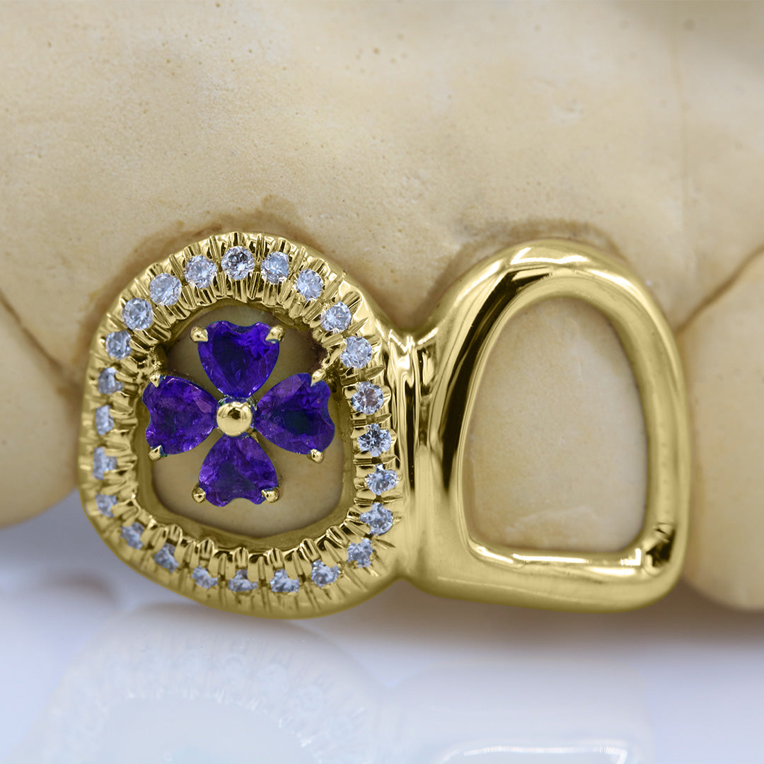 clover_gemstone_grillz_grillz_gold_grillz_grillz_near_me_diamond_grillz_custom_grillz_gold_grillz_near_me_custom_gold_grillz_gold_teeth_grillz_grillz_teeth_near_me_gold_grillz_jewelry_grillz_in_teeth_custom_grillz_near_me_teeth_grillz_grillz_for_teeth_teeth_grillz_near_me_open_face_grillz_grillz_for_teeth_near_me_gold_grillz_teeth_one_tooth_grillz_real_gold_grillz_diamond_grillz_on_teeth_diamond_grillz_teeth_grillz_with_diamond
