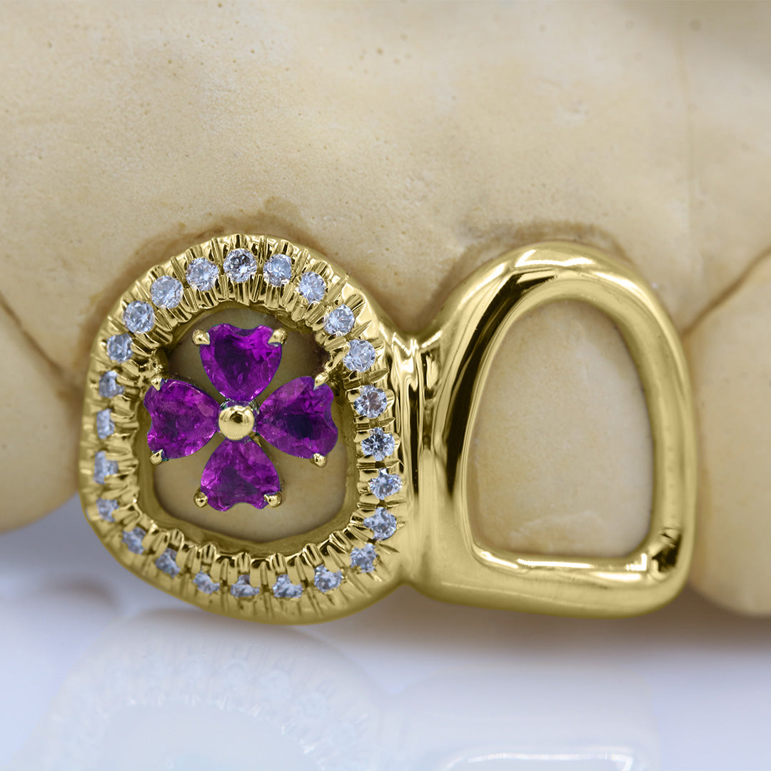 clover_gemstone_grillz_grillz_gold_grillz_grillz_near_me_diamond_grillz_custom_grillz_gold_grillz_near_me_custom_gold_grillz_gold_teeth_grillz_grillz_teeth_near_me_gold_grillz_jewelry_grillz_in_teeth_custom_grillz_near_me_teeth_grillz_grillz_for_teeth_teeth_grillz_near_me_open_face_grillz_grillz_for_teeth_near_me_gold_grillz_teeth_one_tooth_grillz_real_gold_grillz_diamond_grillz_on_teeth_diamond_grillz_teeth_grillz_with_diamond
