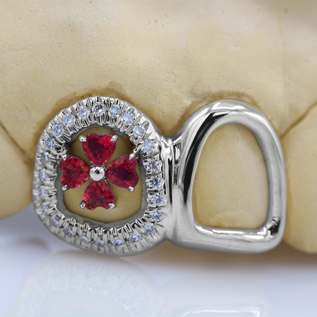 clover_gemstone_grillz_grillz_gold_grillz_grillz_near_me_diamond_grillz_custom_grillz_gold_grillz_near_me_custom_gold_grillz_gold_teeth_grillz_grillz_teeth_near_me_gold_grillz_jewelry_grillz_in_teeth_custom_grillz_near_me_teeth_grillz_grillz_for_teeth_teeth_grillz_near_me_open_face_grillz_grillz_for_teeth_near_me_gold_grillz_teeth_one_tooth_grillz_real_gold_grillz_diamond_grillz_on_teeth_diamond_grillz_teeth_grillz_with_diamond
