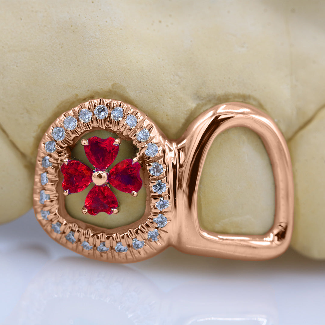 clover_gemstone_grillz_grillz_gold_grillz_grillz_near_me_diamond_grillz_custom_grillz_gold_grillz_near_me_custom_gold_grillz_gold_teeth_grillz_grillz_teeth_near_me_gold_grillz_jewelry_grillz_in_teeth_custom_grillz_near_me_teeth_grillz_grillz_for_teeth_teeth_grillz_near_me_open_face_grillz_grillz_for_teeth_near_me_gold_grillz_teeth_one_tooth_grillz_real_gold_grillz_diamond_grillz_on_teeth_diamond_grillz_teeth_grillz_with_diamond
