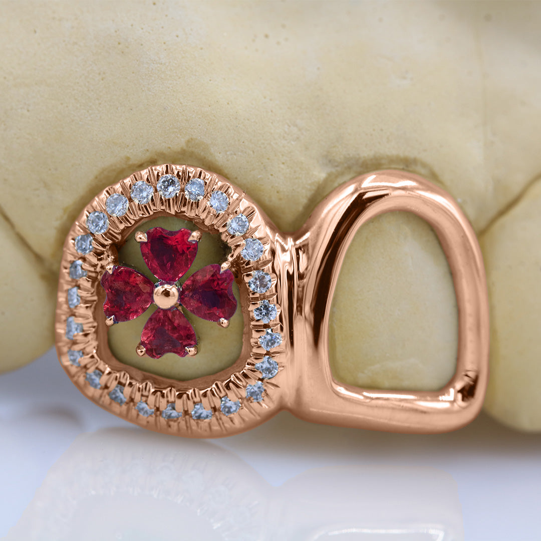 clover_gemstone_grillz_grillz_gold_grillz_grillz_near_me_diamond_grillz_custom_grillz_gold_grillz_near_me_custom_gold_grillz_gold_teeth_grillz_grillz_teeth_near_me_gold_grillz_jewelry_grillz_in_teeth_custom_grillz_near_me_teeth_grillz_grillz_for_teeth_teeth_grillz_near_me_open_face_grillz_grillz_for_teeth_near_me_gold_grillz_teeth_one_tooth_grillz_real_gold_grillz_diamond_grillz_on_teeth_diamond_grillz_teeth_grillz_with_diamond
