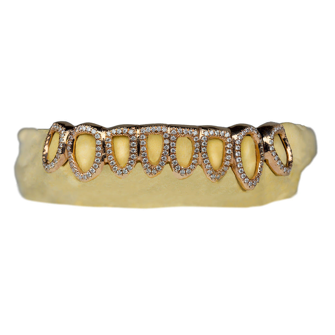 6_on_6_grillz_grillz_bottom_6_6_bottom_grillz_bottom_6_grillz_grillz_6_teeth_6_top_6_bottom_grillz_6_teeth_grillz_6_on_6_gold_grillz_6_piece_grillz_diamond_grillz_diamond_cut_grillz_diamond_dust_grillz_vvs_diamond_grillz_diamond_grillz_on_teeth_diamond_grillz_teeth_grillz_with_diamond_diamond_vvs_grillz_real_diamond_grillz_jewelry_real_diamond_grillz_diamond_grillz_for_teeth_diamond_grillz_near_me_grillz_diamond_dust_vvs_diamonds_grillz_grillz_gold_diamond_diamond_teeth_grillz_open_frame_grillz