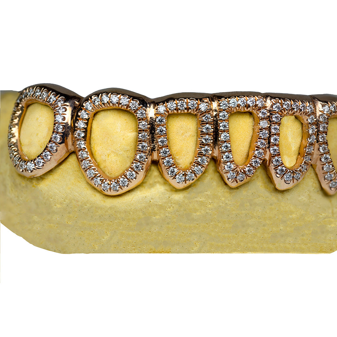 6_on_6_grillz_grillz_bottom_6_6_bottom_grillz_bottom_6_grillz_grillz_6_teeth_6_top_6_bottom_grillz_6_teeth_grillz_6_on_6_gold_grillz_6_piece_grillz_diamond_grillz_diamond_cut_grillz_diamond_dust_grillz_vvs_diamond_grillz_diamond_grillz_on_teeth_diamond_grillz_teeth_grillz_with_diamond_diamond_vvs_grillz_real_diamond_grillz_jewelry_real_diamond_grillz_diamond_grillz_for_teeth_diamond_grillz_near_me_grillz_diamond_dust_vvs_diamonds_grillz_grillz_gold_diamond_diamond_teeth_grillz_open_frame_grillz