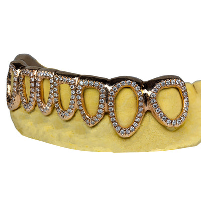6_on_6_grillz_grillz_bottom_6_6_bottom_grillz_bottom_6_grillz_grillz_6_teeth_6_top_6_bottom_grillz_6_teeth_grillz_6_on_6_gold_grillz_6_piece_grillz_diamond_grillz_diamond_cut_grillz_diamond_dust_grillz_vvs_diamond_grillz_diamond_grillz_on_teeth_diamond_grillz_teeth_grillz_with_diamond_diamond_vvs_grillz_real_diamond_grillz_jewelry_real_diamond_grillz_diamond_grillz_for_teeth_diamond_grillz_near_me_grillz_diamond_dust_vvs_diamonds_grillz_grillz_gold_diamond_diamond_teeth_grillz_open_frame_grillz