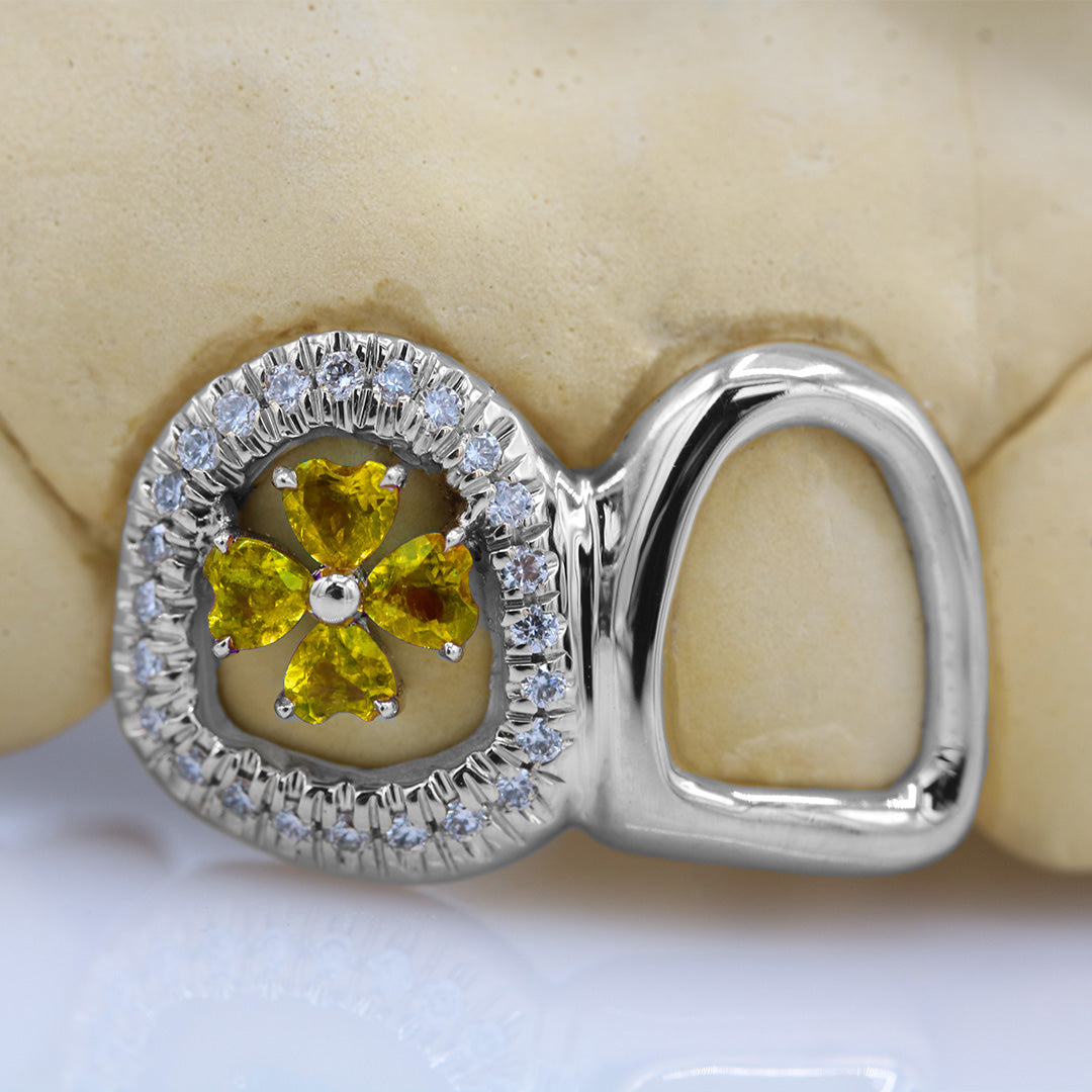 clover_gemstone_grillz_grillz_gold_grillz_grillz_near_me_diamond_grillz_custom_grillz_gold_grillz_near_me_custom_gold_grillz_gold_teeth_grillz_grillz_teeth_near_me_gold_grillz_jewelry_grillz_in_teeth_custom_grillz_near_me_teeth_grillz_grillz_for_teeth_teeth_grillz_near_me_open_face_grillz_grillz_for_teeth_near_me_gold_grillz_teeth_one_tooth_grillz_real_gold_grillz_diamond_grillz_on_teeth_diamond_grillz_teeth_grillz_with_diamond
