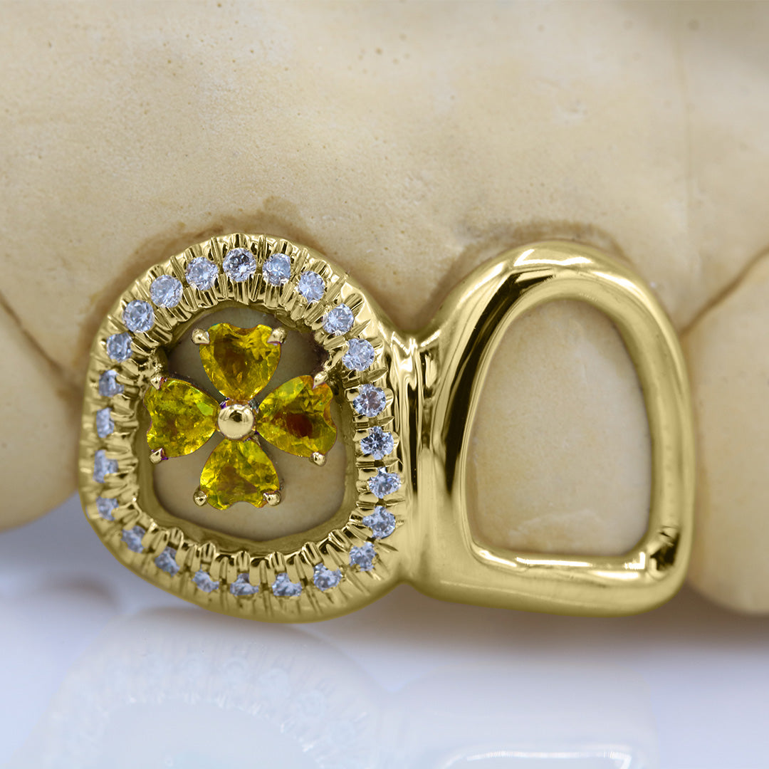 clover_gemstone_grillz_grillz_gold_grillz_grillz_near_me_diamond_grillz_custom_grillz_gold_grillz_near_me_custom_gold_grillz_gold_teeth_grillz_grillz_teeth_near_me_gold_grillz_jewelry_grillz_in_teeth_custom_grillz_near_me_teeth_grillz_grillz_for_teeth_teeth_grillz_near_me_open_face_grillz_grillz_for_teeth_near_me_gold_grillz_teeth_one_tooth_grillz_real_gold_grillz_diamond_grillz_on_teeth_diamond_grillz_teeth_grillz_with_diamond
