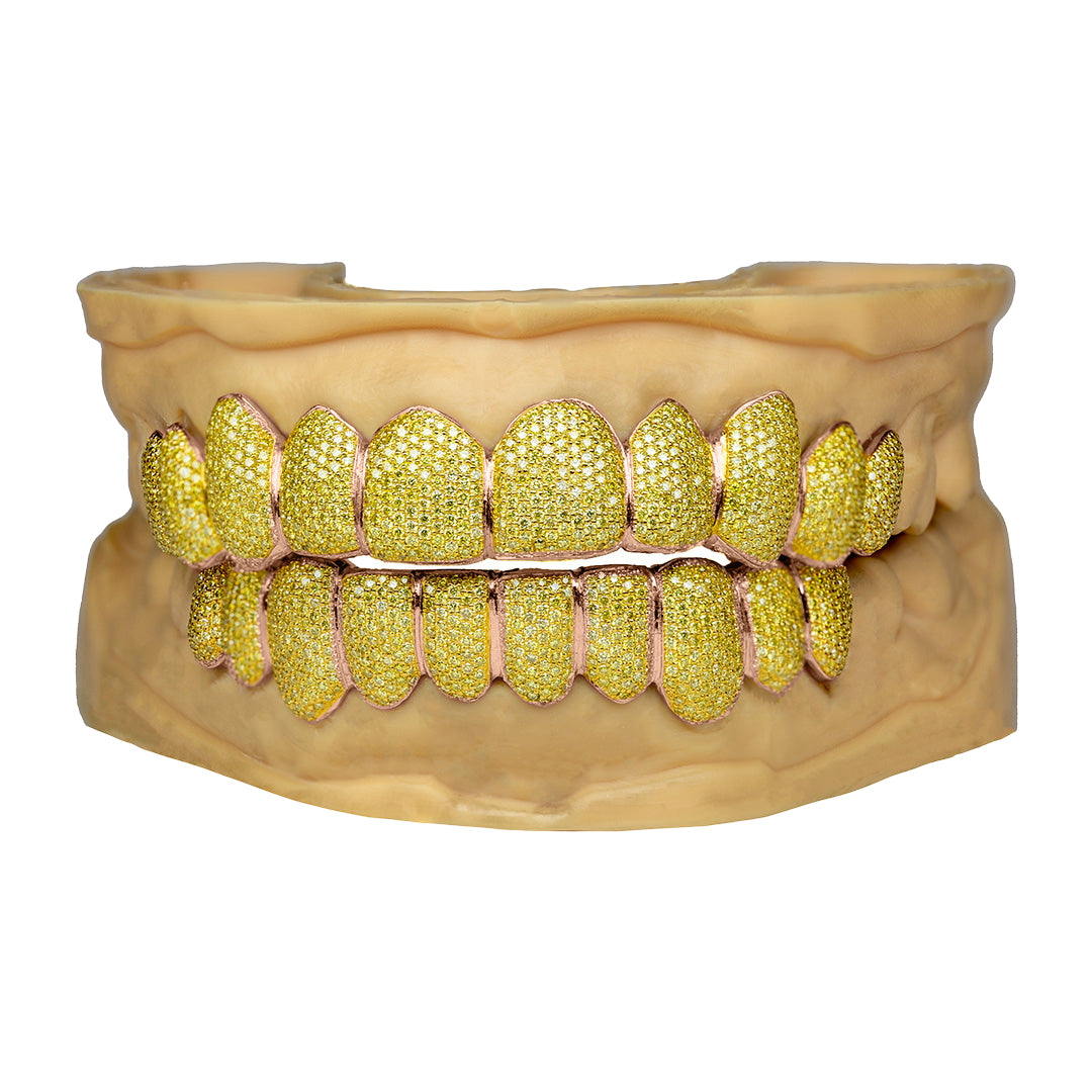 moissanite_grillz_24k_gold_grillz_grillz_24k_gold_moissanite_grillz_near_me_grillz_nyc_grillz_with_diamond_cuts_diamond_grillz_in_mouth_rapper_grillz_jewelry_diamond_gold_grillz_gold_diamond_cut_grillz_mouthpiece_grillz_custom_moissanite_grillz_diamond_grillz_bottom_8_on_8_grillz_grillz_teeth_diamond_diamond_dust_grillz_gold_cz_grillz_teeth_diamond_grillz_diamond_grill_grills_teeth_custom_grillz_teeth_grills_diamond_grill_diamond_grille_diamond_cut_grillz