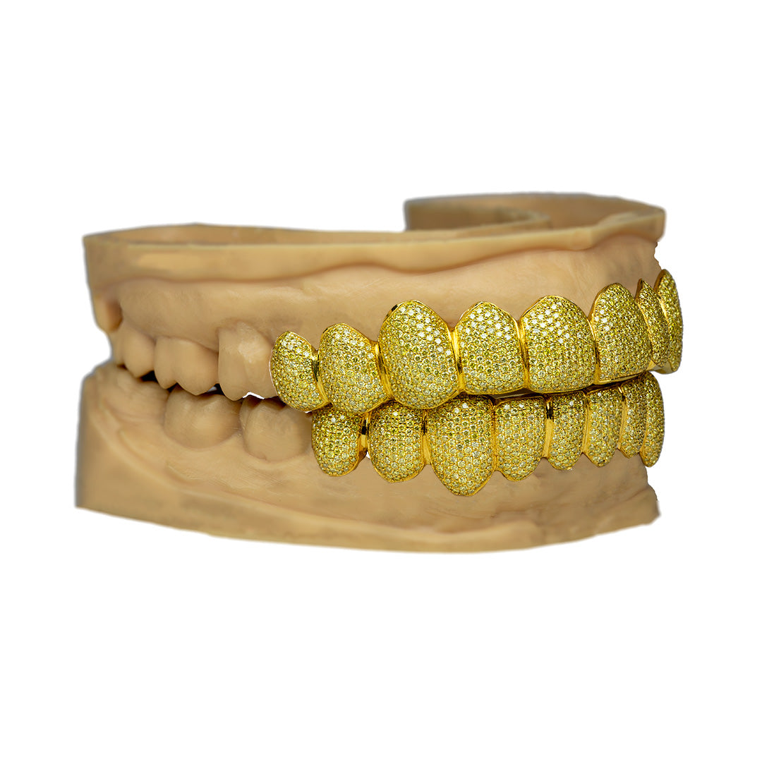 moissanite_grillz_24k_gold_grillz_grillz_24k_gold_moissanite_grillz_near_me_grillz_nyc_grillz_with_diamond_cuts_diamond_grillz_in_mouth_rapper_grillz_jewelry_diamond_gold_grillz_gold_diamond_cut_grillz_mouthpiece_grillz_custom_moissanite_grillz_diamond_grillz_bottom_8_on_8_grillz_grillz_teeth_diamond_diamond_dust_grillz_gold_cz_grillz_teeth_diamond_grillz_diamond_grill_grills_teeth_custom_grillz_teeth_grills_diamond_grill_diamond_grille_diamond_cut_grillz